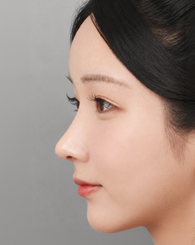 수술 후 측면