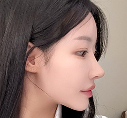 수술 후 사진 3
